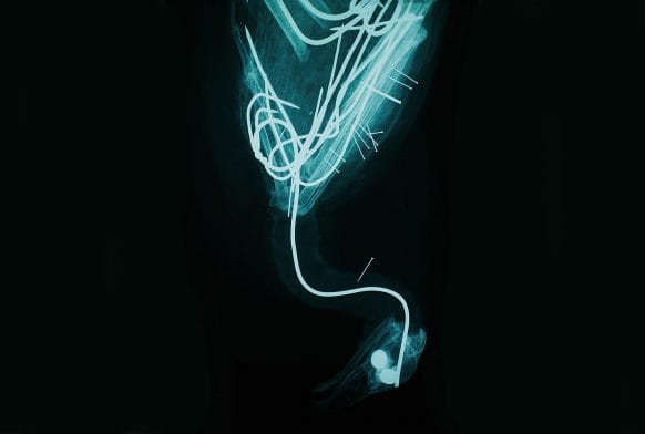 Falling Birds sing their stories at the Horniman